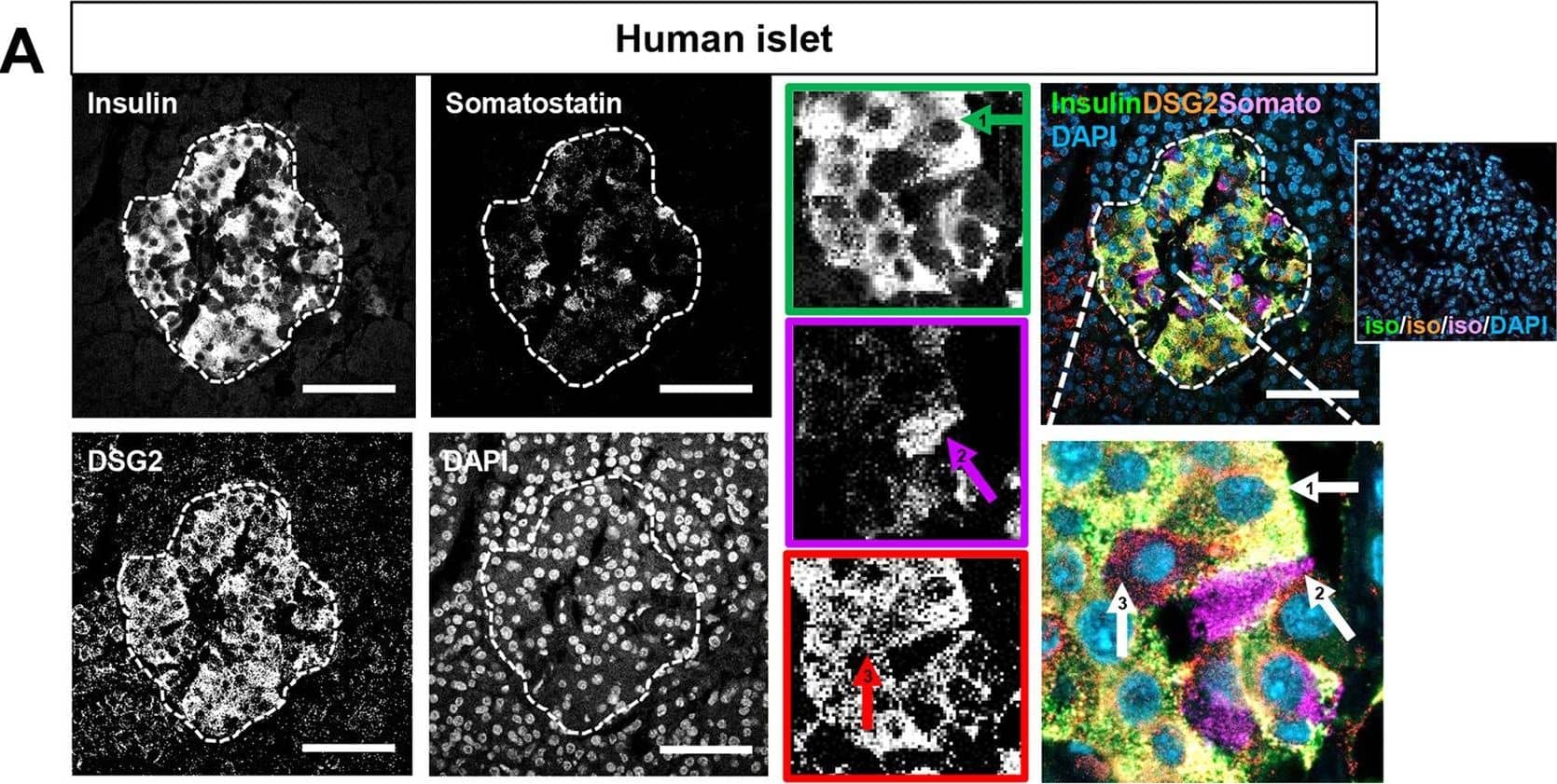 Detection of Desmoglein-2 by Immunohistochemistry