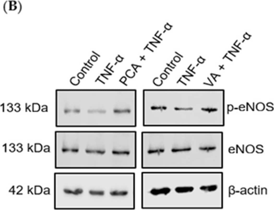 Detection of Human eNOS by Western Blot