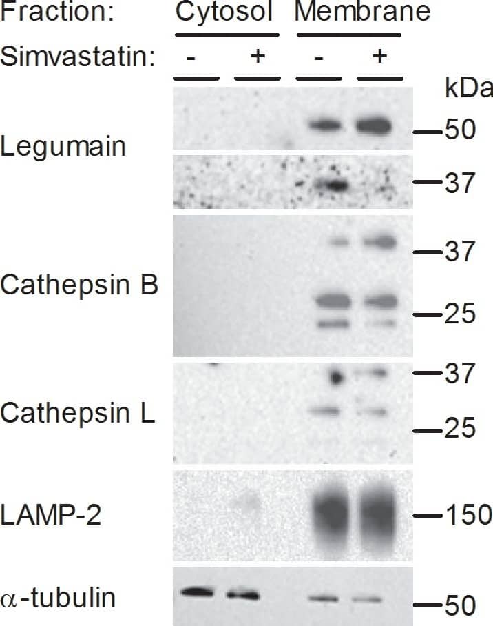 Detection of Human Cathepsin L by Western Blot