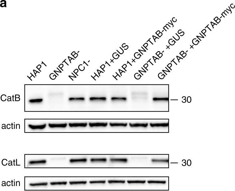 Detection of Human Cathepsin L by Western Blot