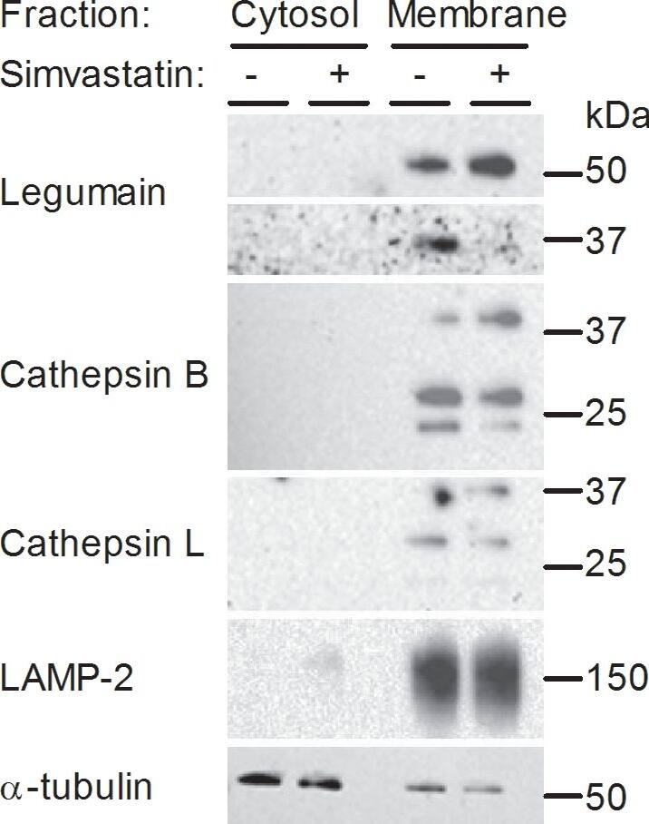 Detection of Human Cathepsin B by Western Blot