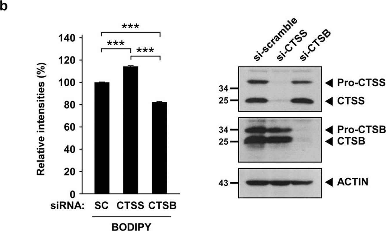 Detection of Human Cathepsin B by Western Blot