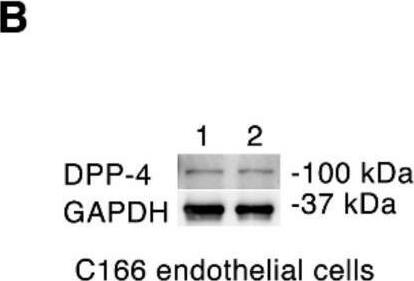 Detection of DPPIV/CD26 by Western Blot