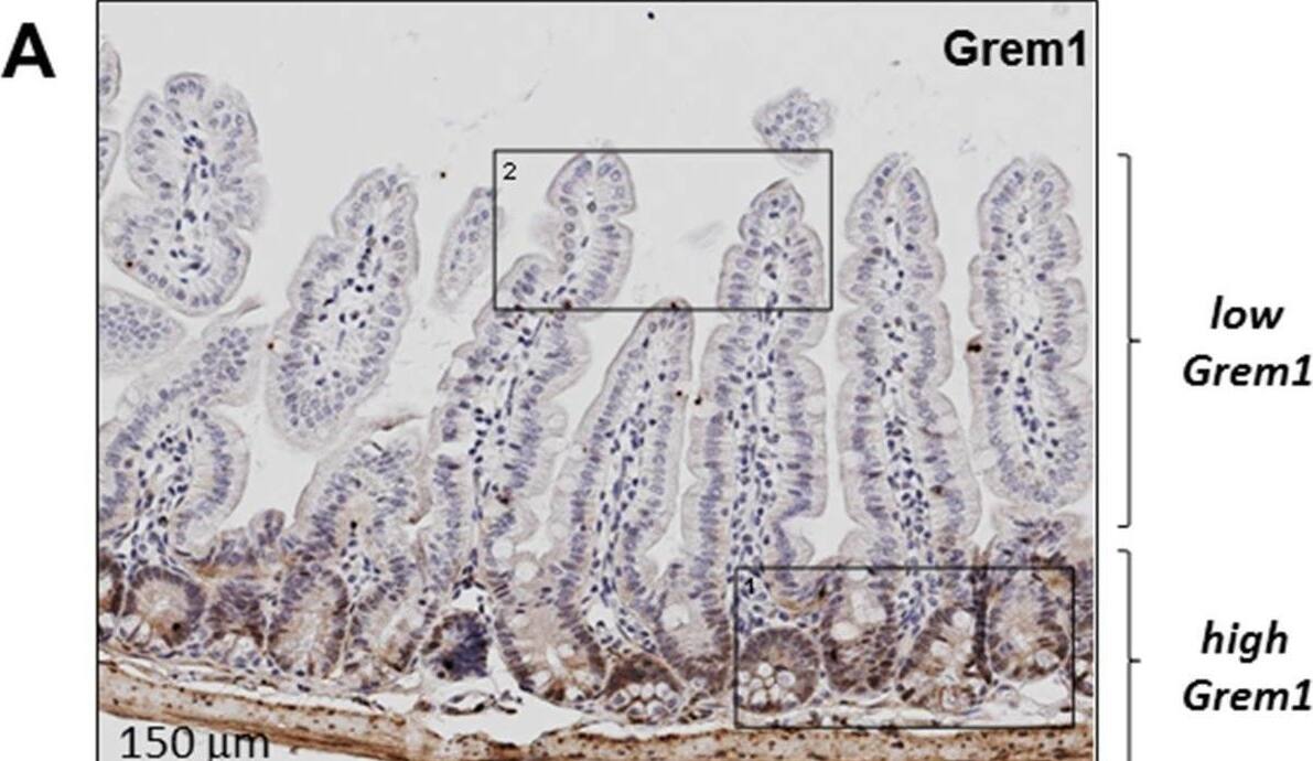 Detection of Gremlin by Immunohistochemistry