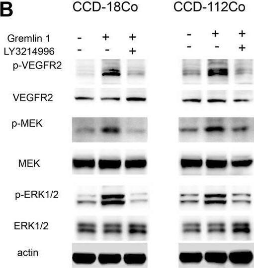 Detection of Gremlin by Western Blot
