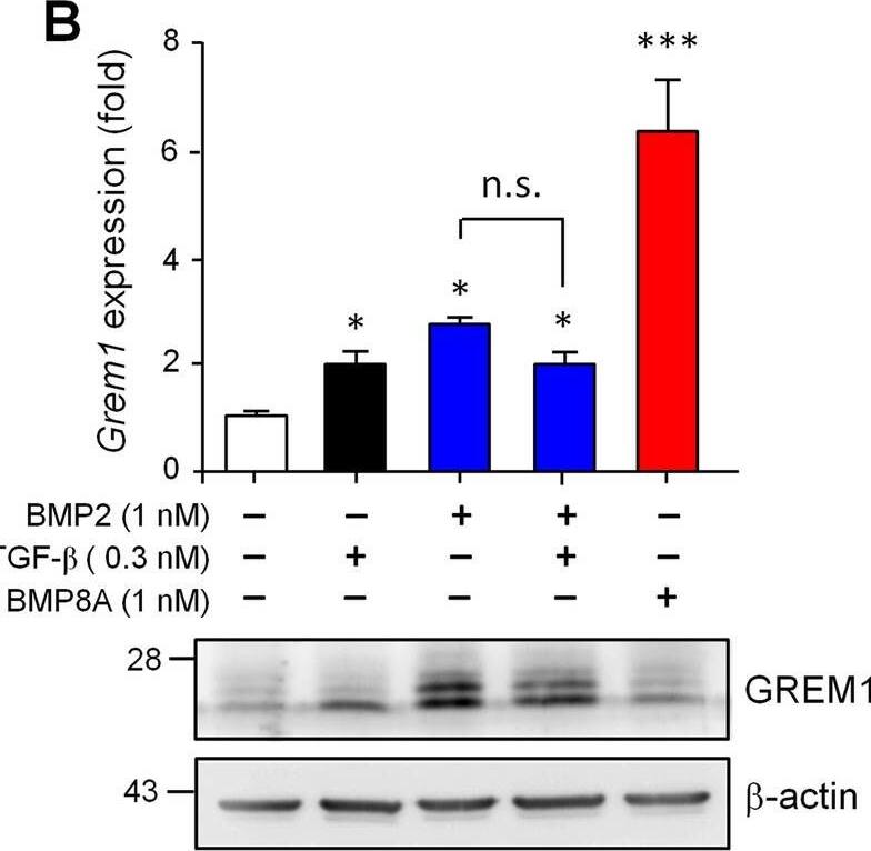 Detection of Gremlin by Western Blot