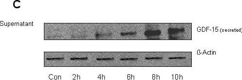 Detection of Human GDF-15 by Western Blot