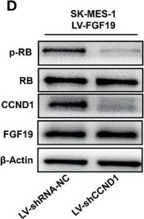 Detection of FGF-19 by Western Blot