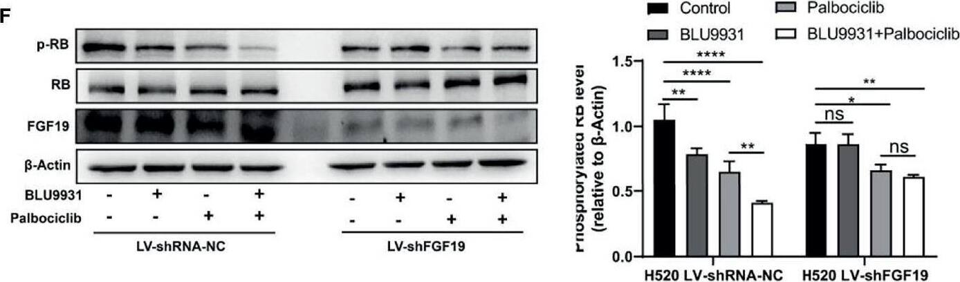 Detection of FGF-19 by Western Blot