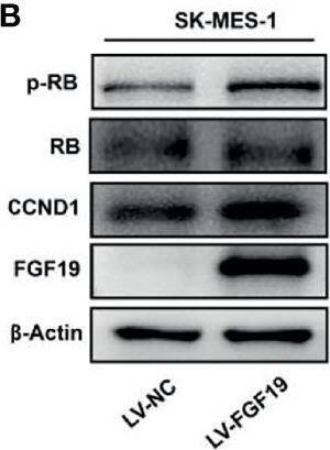 Detection of FGF-19 by Western Blot