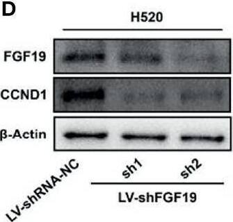 Detection of FGF-19 by Western Blot