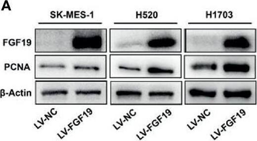 Detection of FGF-19 by Western Blot