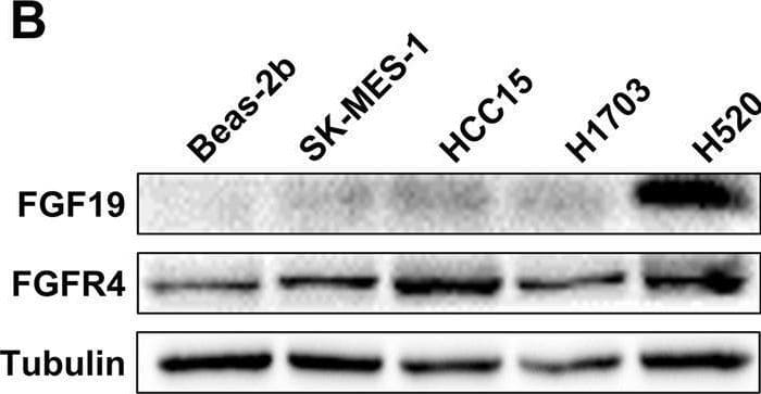 Detection of FGF-19 by Western Blot