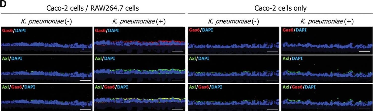 Detection of Gas6 by Immunohistochemistry