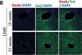 Detection of Gas6 by Immunohistochemistry