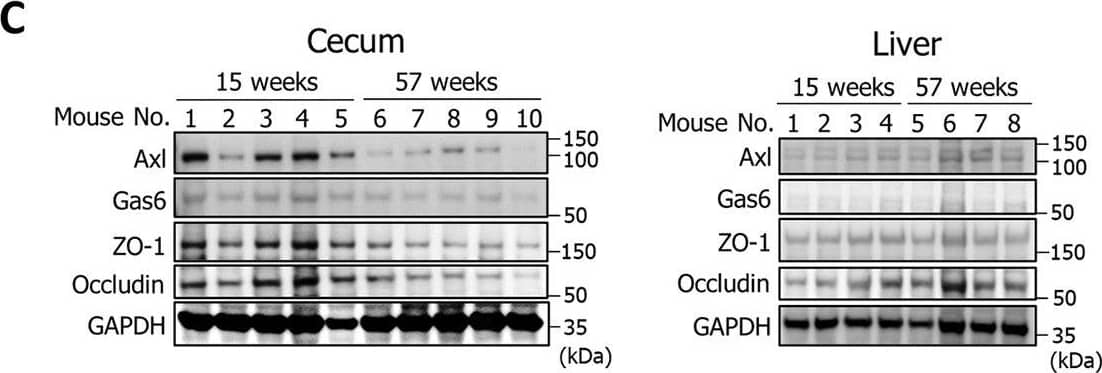 Detection of Gas6 by Western Blot