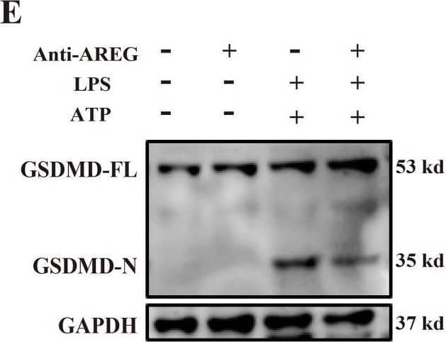 Detection of Amphiregulin by Western Blot