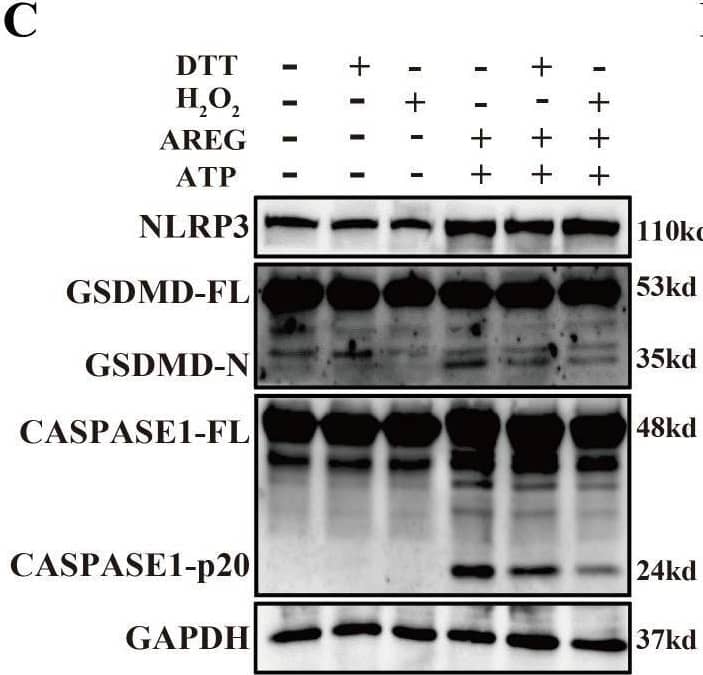 Detection of Amphiregulin by Western Blot