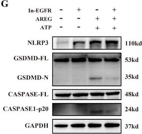 Detection of Amphiregulin by Western Blot