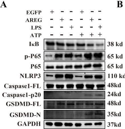 Detection of Amphiregulin by Western Blot