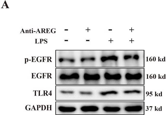 Detection of Amphiregulin by Western Blot