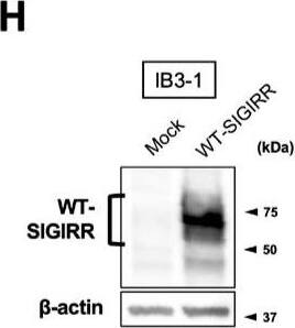 Detection of SIGIRR by Western Blot