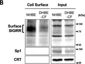 Detection of SIGIRR by Western Blot