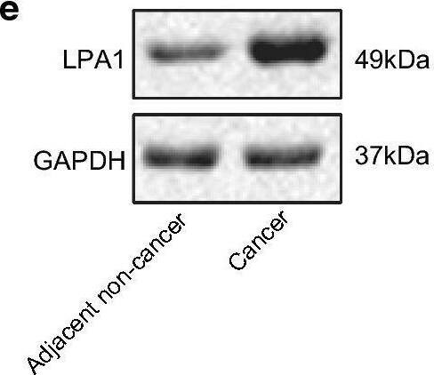 Detection of LPAR1/LPA1/EDG-2 by Western Blot