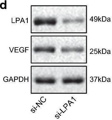 Detection of LPAR1/LPA1/EDG-2 by Western Blot