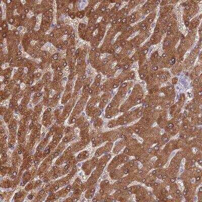 Immunohistochemistry: alcohol dehydrogenase 1A Antibody [NBP2-46756]