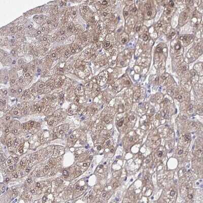 Immunohistochemistry-Paraffin: alcohol dehydrogenase 1A Antibody [NBP2-46861]