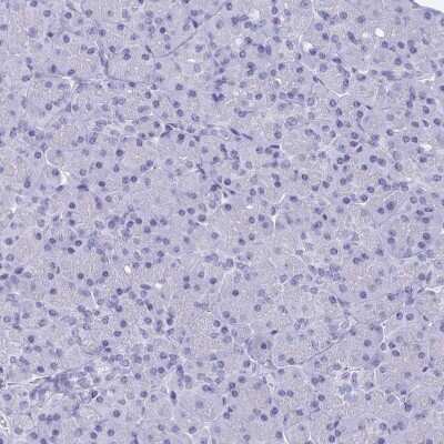 Immunohistochemistry-Paraffin: alcohol dehydrogenase 1A Antibody [NBP2-46861]