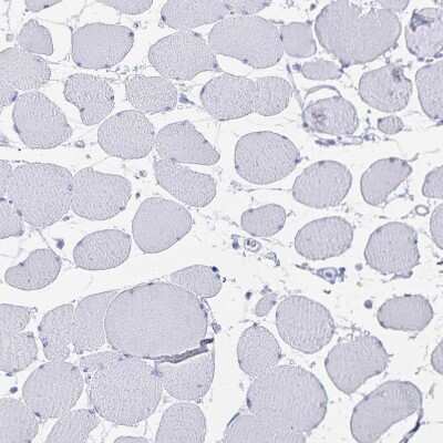 Immunohistochemistry-Paraffin: alcohol dehydrogenase 1A Antibody [NBP2-46861]