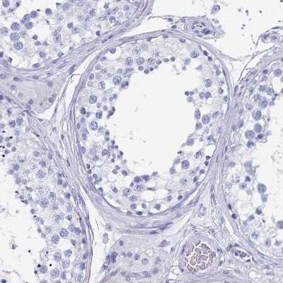 Immunohistochemistry-Paraffin: alcohol dehydrogenase 1A Antibody [NBP2-46861]