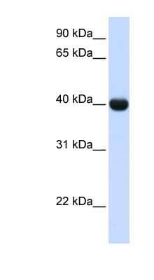 Western Blot: alcohol dehydrogenase 1A Antibody [NBP1-57671]