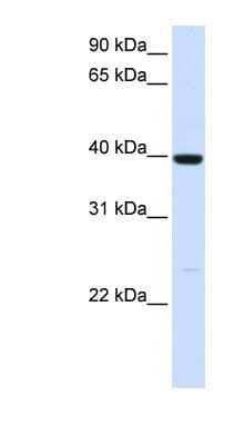 Western Blot: alcohol dehydrogenase 1A Antibody [NBP1-57672]