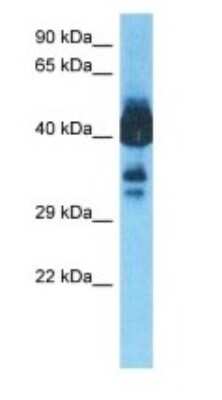 Western Blot: alcohol dehydrogenase 1A Antibody [NBP3-10788]