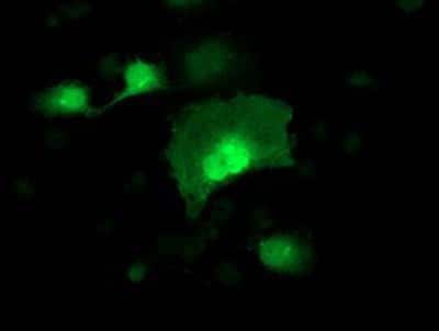 Immunocytochemistry/ Immunofluorescence: alcohol dehydrogenase 1B Antibody (OTI4F12) [NBP2-00649]