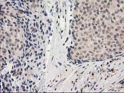Immunohistochemistry-Paraffin: alcohol dehydrogenase 1B Antibody (OTI4F12) [NBP2-00649]