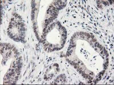 Immunohistochemistry-Paraffin: alcohol dehydrogenase 1B Antibody (OTI4F12) [NBP2-00649]