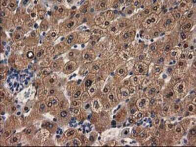 Immunohistochemistry-Paraffin: alcohol dehydrogenase 1B Antibody (OTI4F12) [NBP2-00649]