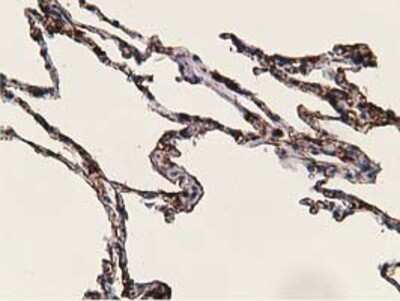 Immunohistochemistry-Paraffin: alcohol dehydrogenase 1B Antibody (OTI4F12) [NBP2-00649]