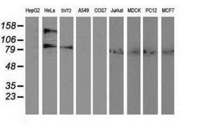 Western Blot: alcohol dehydrogenase 1B Antibody (OTI4F12) [NBP2-00649]