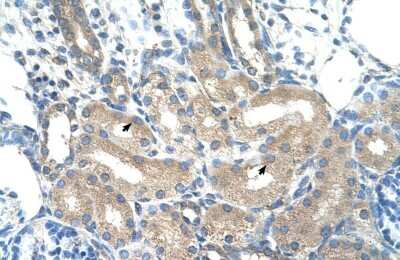 Immunohistochemistry-Paraffin: alcohol dehydrogenase 1B Antibody [NBP2-86573]