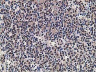 Immunohistochemistry: alcohol dehydrogenase 1B Antibody (OTI4F12) - Azide and BSA Free [NBP2-70092]
