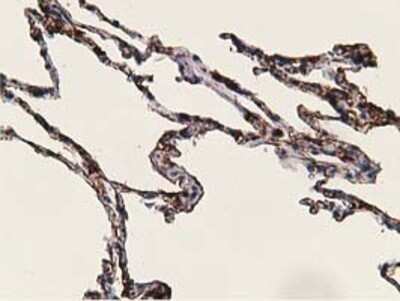 Immunohistochemistry: alcohol dehydrogenase 1B Antibody (OTI4F12) - Azide and BSA Free [NBP2-70092]
