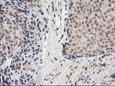 Immunohistochemistry: alcohol dehydrogenase 1B Antibody (OTI4F12) - Azide and BSA Free [NBP2-70092]