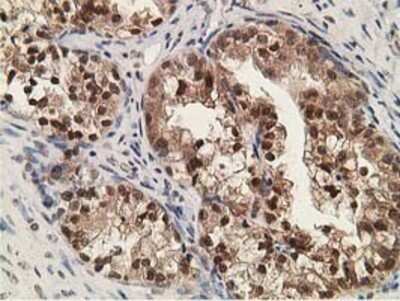 Immunohistochemistry: alcohol dehydrogenase 1B Antibody (OTI4F12) - Azide and BSA Free [NBP2-70092]