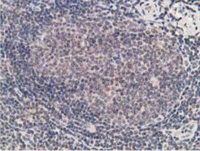 Immunohistochemistry: alcohol dehydrogenase 1B Antibody (OTI4F12) - Azide and BSA Free [NBP2-70092]