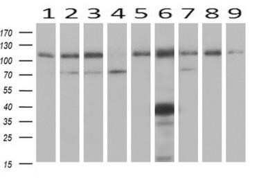 Western Blot: alcohol dehydrogenase 1B Antibody (OTI4F12)Azide and BSA Free [NBP2-70092]